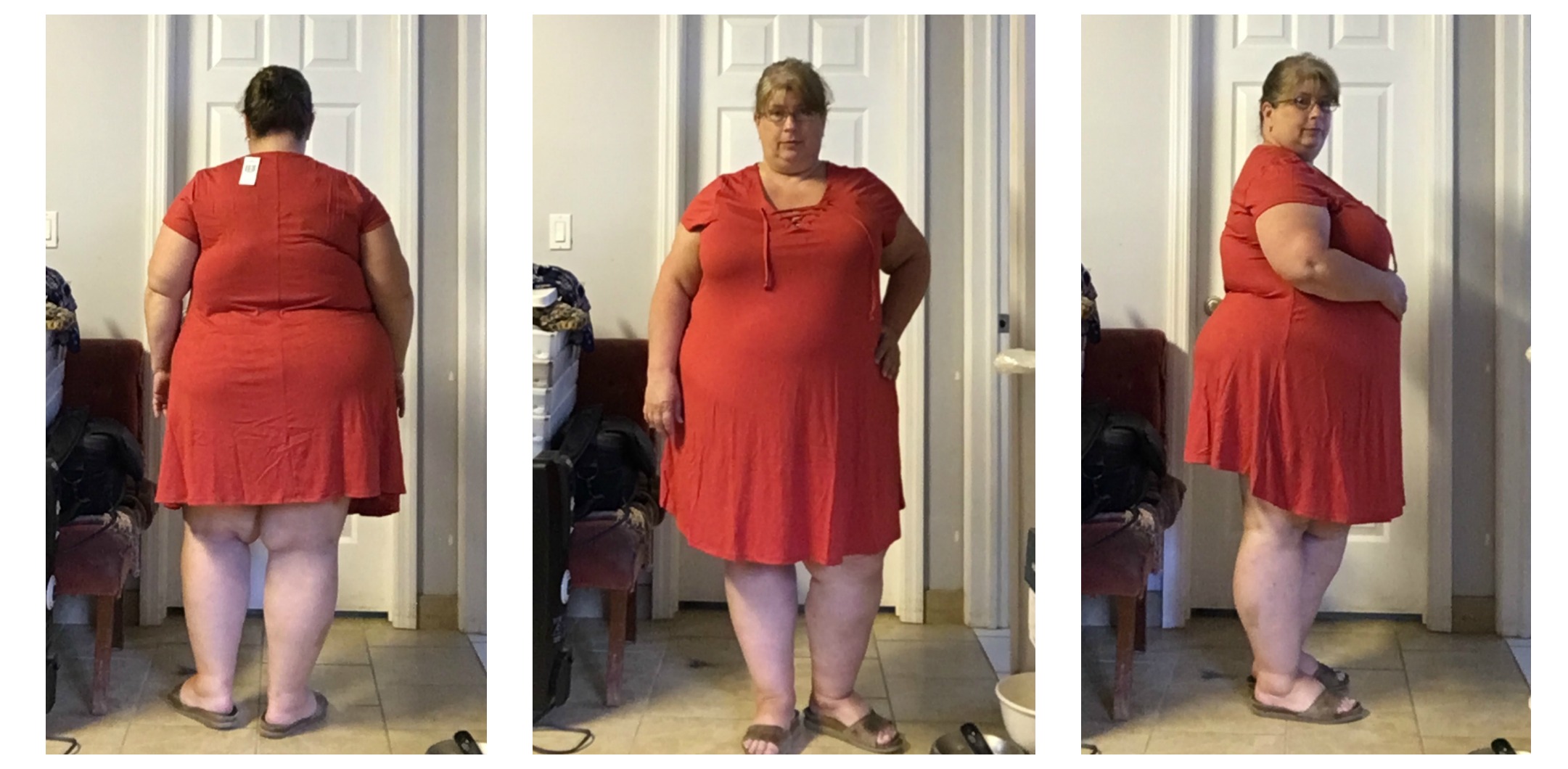 lovesick dress collage